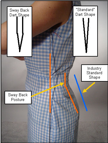 Dart Shaping for Sway Back Postures